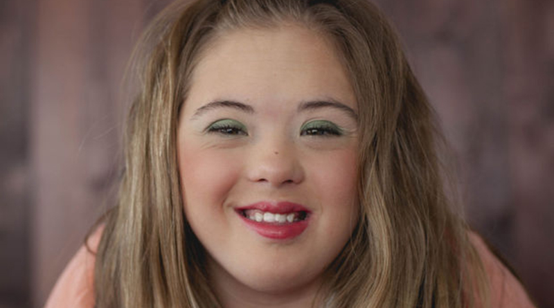 Teen with down syndrome shapes body and became a model to 