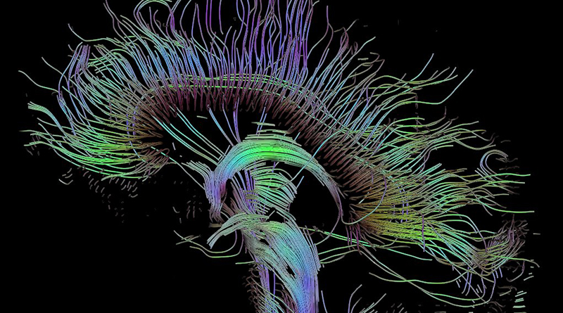 Charting New Territory In The Brain