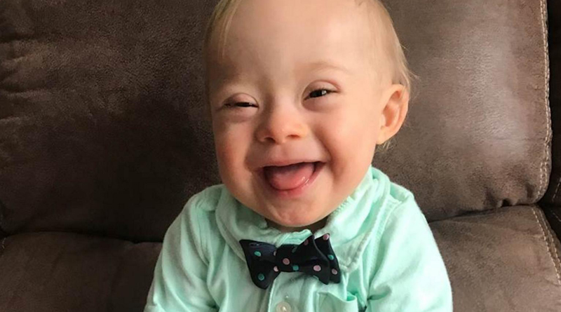 2018 Gerber Baby Has Down Syndrome Adorable Smile