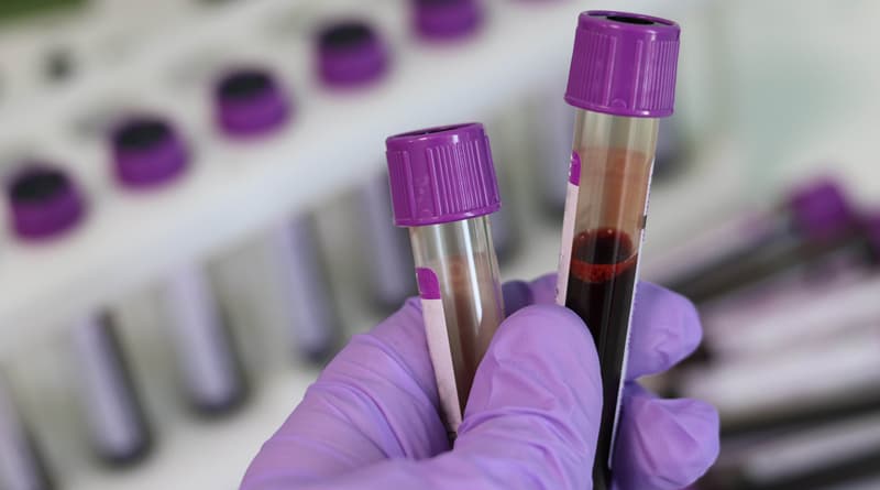 Blood Test May Help Identify & Treat PTSD More Effectively